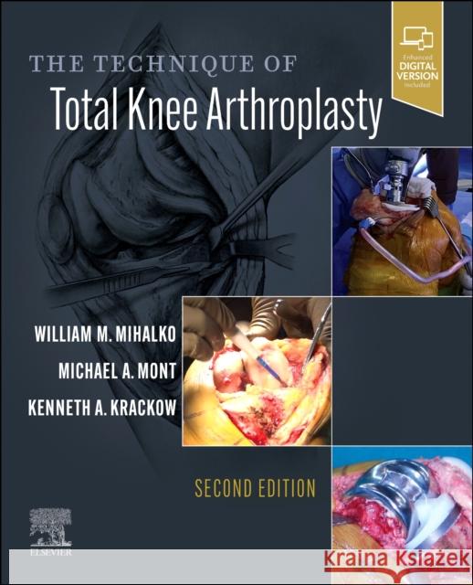 The Technique of Total Knee Arthroplasty William M. Mihalko Michael A. Mont Kenneth Krackow 9780323713023