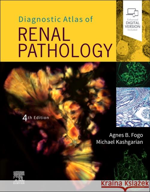 Diagnostic Atlas of Renal Pathology Agnes B. Fogo Michael Kashgarian 9780323721639