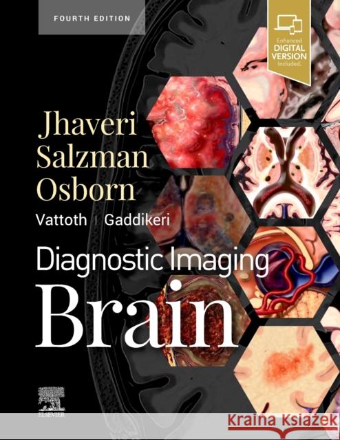 Diagnostic Imaging: Brain Miral D. Jhaveri 9780323756204