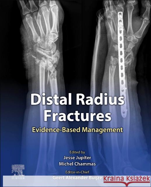 Distal Radius Fractures: Evidence-Based Management Geert Buijze Jesse B. Jupiter Michael Chammas 9780323757645 Elsevier - Health Sciences Division