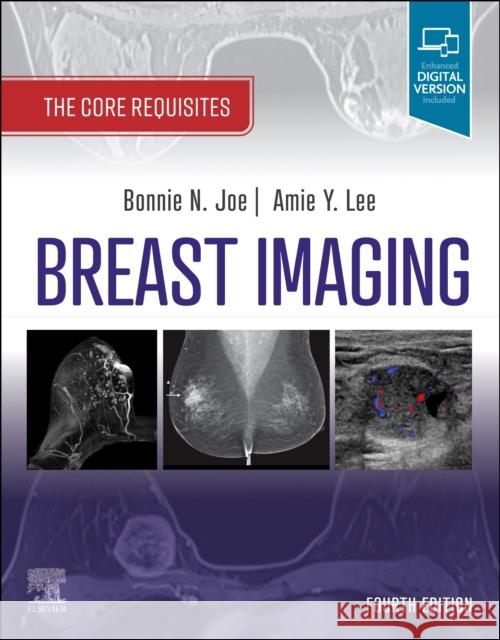 Breast Imaging: The Core Requisites Bonnie N. Joe Amie Y. Lee 9780323758499 Elsevier