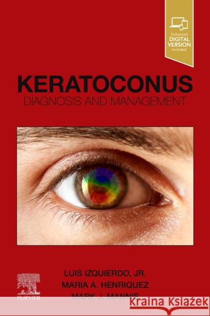 Keratoconus: Diagnosis and Management Luis Izquierdo Maria Henriquez Mark J. Mannis 9780323759786 Elsevier