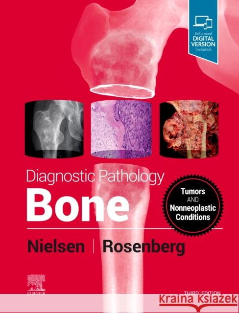 Diagnostic Pathology: Bone Gunnlaugur Petu Andrew E. Rosenberg 9780323765336