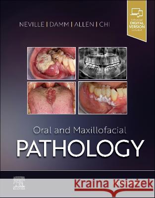 Oral and Maxillofacial Pathology Brad W. Neville Douglas D. Damm Carl M. Allen 9780323789813