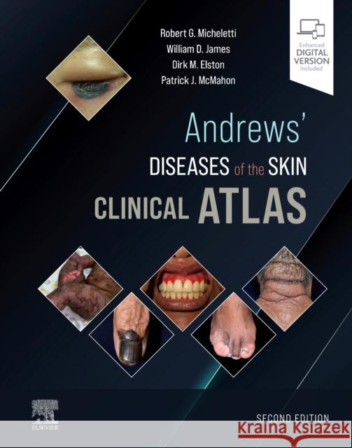 Andrews' Diseases of the Skin Clinical Atlas WILLIAM D. JAMES 9780323790130 ELSEVIER HS08A