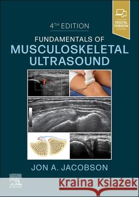 Fundamentals of Musculoskeletal Ultrasound Jon A. Jacobson 9780323791502 Elsevier