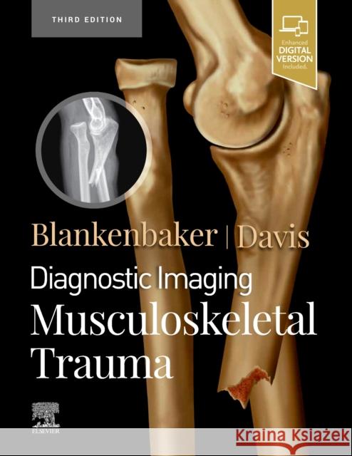 Diagnostic Imaging: Musculoskeletal Trauma Kirkland W. Davis 9780323793933 Elsevier - Health Sciences Division