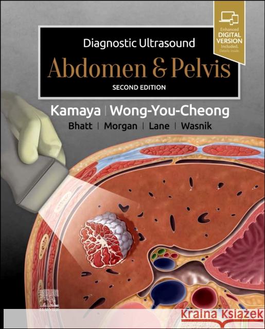 Diagnostic Ultrasound: Abdomen and Pelvis Aya Kamaya Jade Wong-You-Cheong 9780323794022 Elsevier - Health Sciences Division