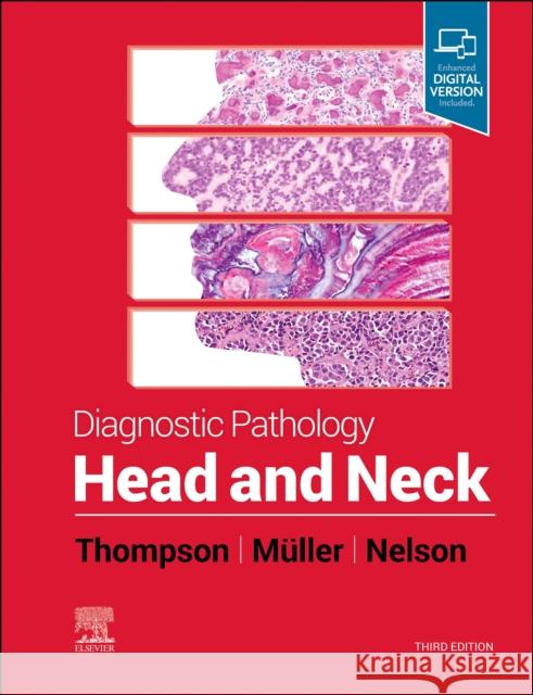 Diagnostic Pathology: Head and Neck Lester D. R. Thompson 9780323794060 Elsevier