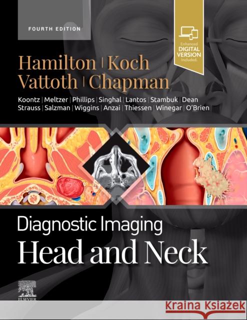 Diagnostic Imaging: Head and Neck Bernadette L. Koch 9780323796507 Elsevier - Health Sciences Division