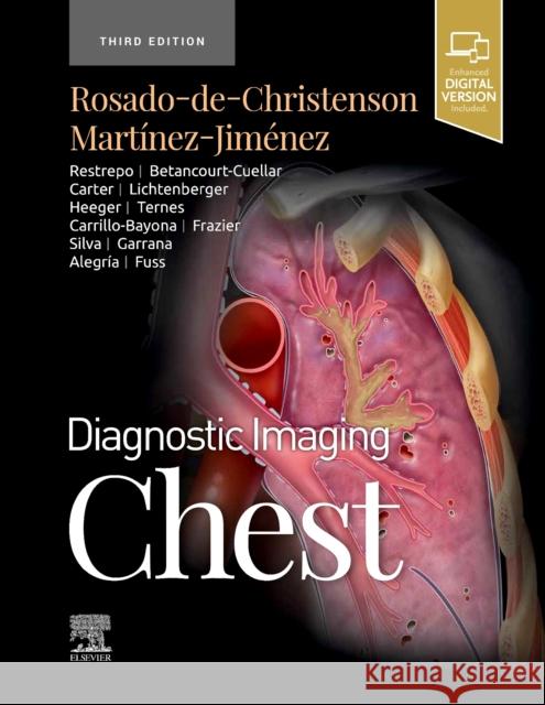 Diagnostic Imaging: Chest Melissa L. Rosado-De-Christenson Santiago Mart 9780323796637