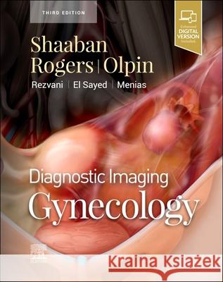 Diagnostic Imaging: Gynecology Akram M. Shaaban 9780323796927 Elsevier