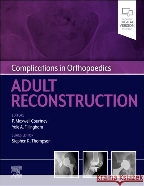 Complications in Orthopaedics: Adult Reconstruction PAUL MAXWE COURTNEY 9780323824378 ELSEVIER HS08A