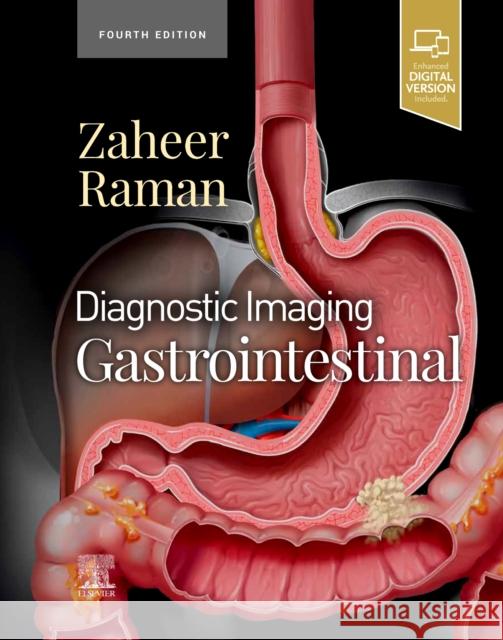 Diagnostic Imaging: Gastrointestinal Atif Zaheer Siva P. Raman 9780323824989 Elsevier