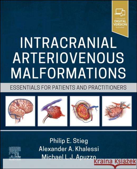 Intracranial Arteriovenous Malformations: Essentials for Patients and Practitioners  9780323825306 Elsevier - Health Sciences Division