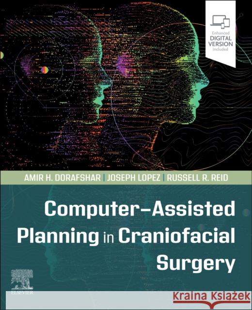 Computer-Assisted Planning in Craniofacial Surgery Amir H. Dorafshar Joseph Lopez Russell R. Reid 9780323826686 Elsevier - Health Sciences Division