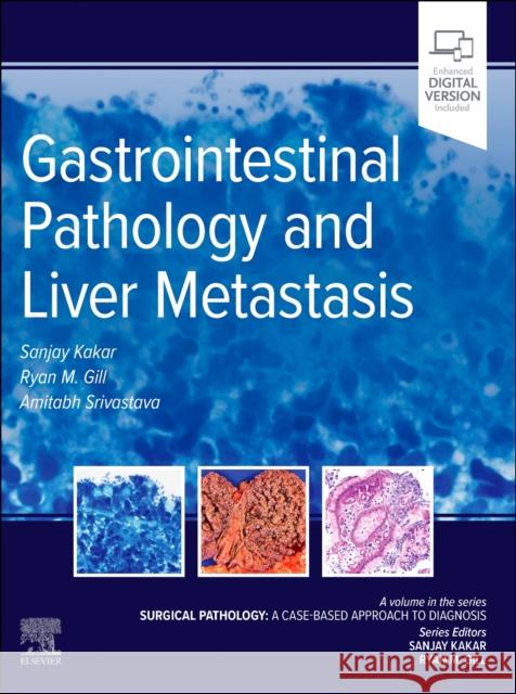 Gastrointestinal Pathology and Liver Metastasis: A Case-Based Approach to Diagnosis Sanjay Kakar Ryan M. Gill Amitabh Srivastava 9780323826884 Elsevier