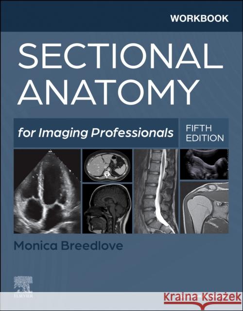 Workbook for Sectional Anatomy for Imaging Professionals Monica, M.Ed., RT(R)(M)(CT)(MR) (Clinical Associate Professor, Boise State University, Boise, Idaho, USA) Breedlove 9780323827928 Elsevier - Health Sciences Division