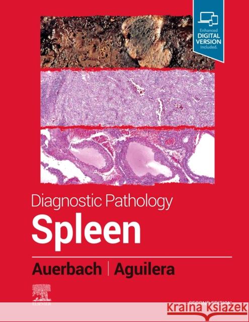 Diagnostic Pathology: Spleen Aaron Auerbach Nadine Aguilera 9780323830126 Elsevier