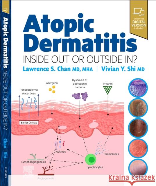 Atopic Dermatitis: Inside Out or Outside in Chan, Lawrence S. 9780323847445 Elsevier