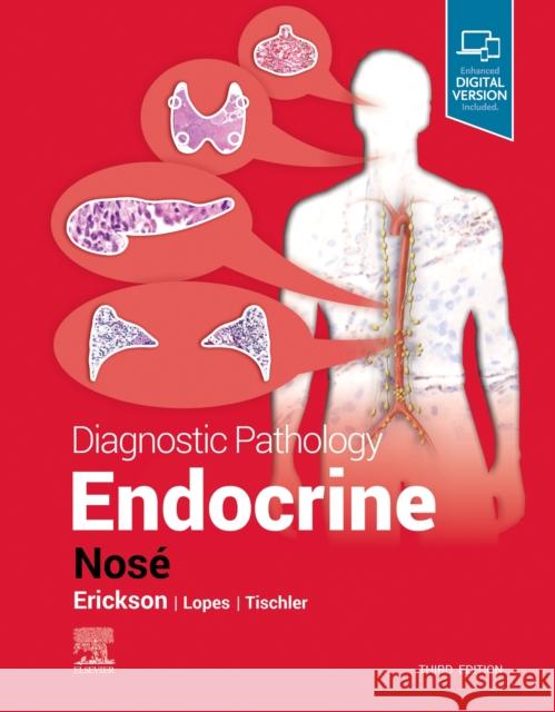 Diagnostic Pathology: Endocrine Nos 9780323847551 Elsevier