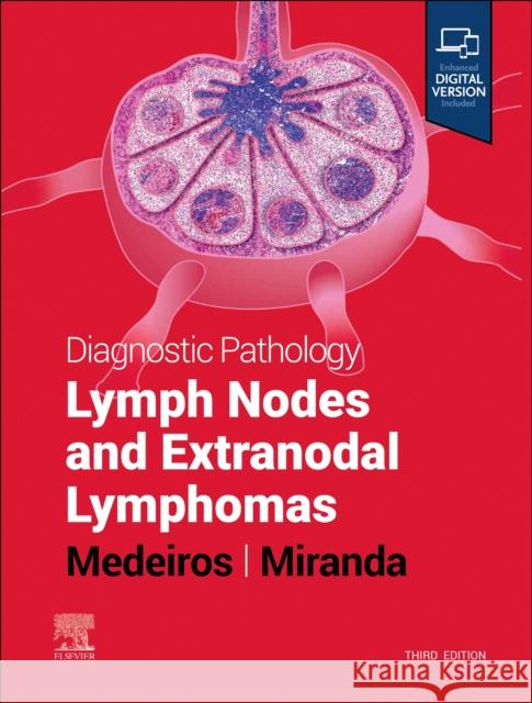 Diagnostic Pathology: Lymph Nodes and Extranodal Lymphomas L. Jeffrey Medeiros Roberto N. Miranda 9780323847582