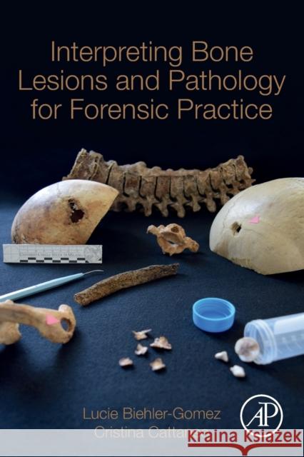 Interpreting Bone Lesions and Pathology for Forensic Practice Cristina Cattaneo Lucie Biehler Gomez 9780323851626 Academic Press