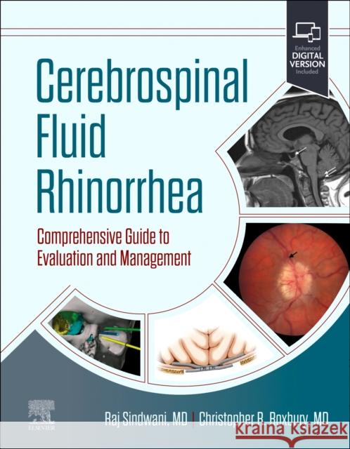 Cerebrospinal Fluid Rhinorrhea: Comprehensive Guide to Evaluation and Management Raj Sindwani Christopher Roxbury 9780323870726 Elsevier