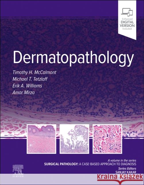 Dermatopathology: Surgical Pathology: A Case-Based Approach to Diagnosis Tim McCalmont Michael Tetzlaff Erik A. Williams 9780323871037 Elsevier - Health Sciences Division