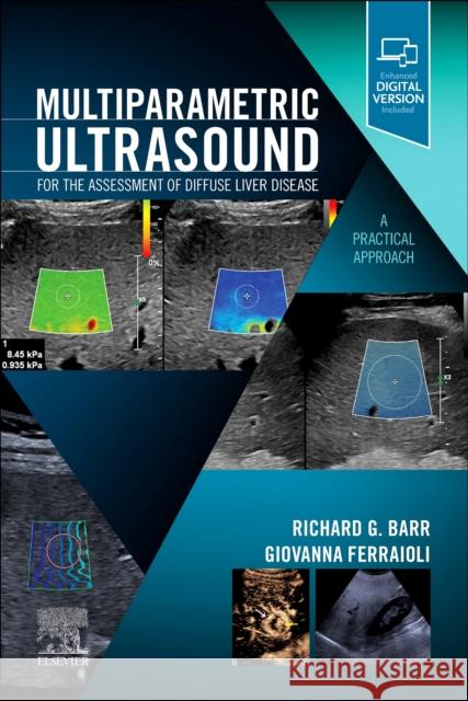 Multiparametric Ultrasound for the Assessment of Diffuse Liver Disease: A Practical Approach  9780323874793 Elsevier - Health Sciences Division