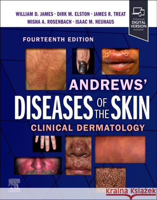 Andrews' Diseases of the Skin: Clinical Dermatology William D. James Dirk M. Elston James R. Treat 9780323878708 Elsevier - Health Sciences Division