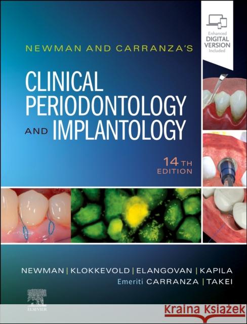 Newman and Carranza's Clinical Periodontology and Implantology Yvonne, DDS, PhD (Professor and Chair, Division of Periodontology,Department of Orofacial Sciences at UCSF. Diplomate, A 9780323878876 Elsevier - Health Sciences Division