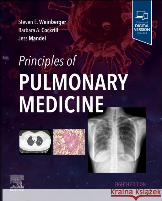 Principles of Pulmonary Medicine Steven E. Weinberger Barbara A. Cockrill Jess Mandel 9780323880565