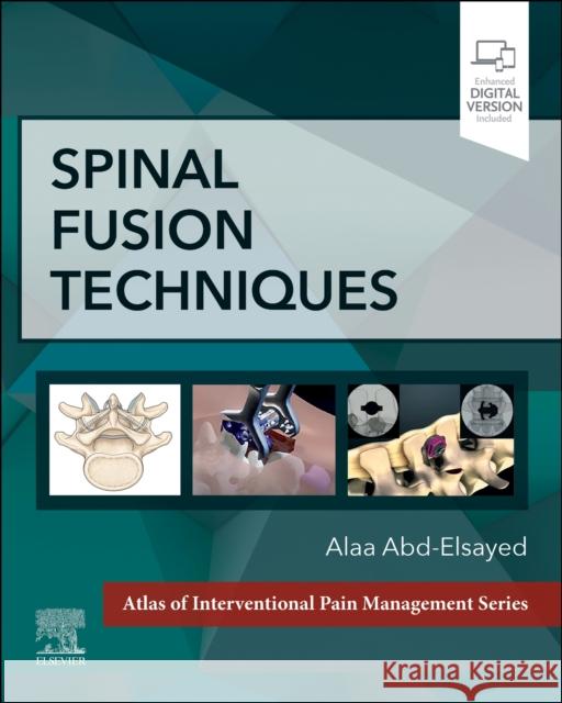 Spinal Fusion Techniques Alaa, MD, MPH, FASA (Medical Director, UW Pain Clinic, Division Chief, Chronic Pain Medicine, University of Wisconsin-Ma 9780323882231 Elsevier - Health Sciences Division