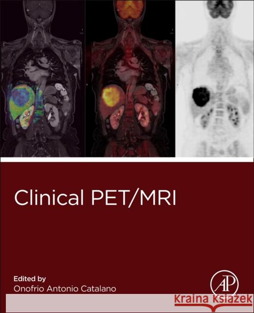 Clinical Pet/MR Onofrio Antonio Catalano 9780323885379 Academic Press