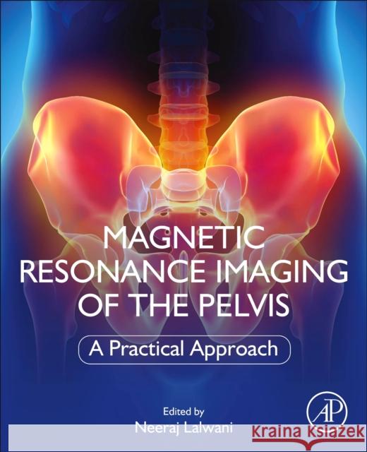 Magnetic Resonance Imaging of the Pelvis: A Practical Approach Lalwani, Neeraj 9780323898546 Elsevier Science & Technology