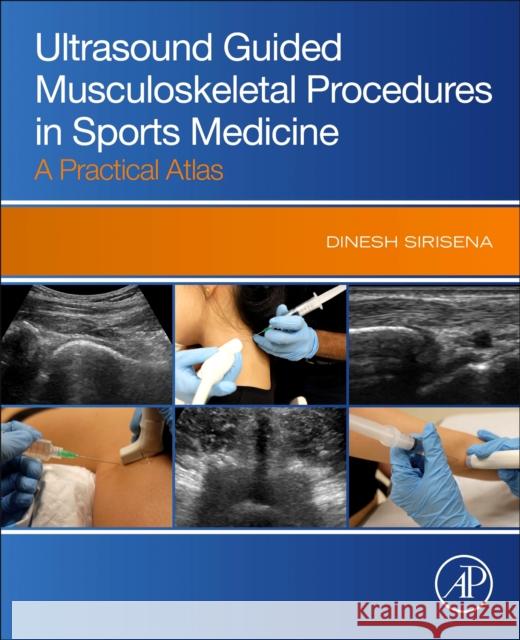 Ultrasound Guided Musculoskeletal Procedures Dinesh Sirisena 9780323910149