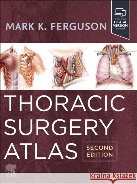 Thoracic Surgery Atlas Mark K. (Professor of Surgery, University of Chicago Hospitals, Section of Cardiac and Thoracic Surgery, Chicago, IL) Fe 9780323930222 Elsevier - Health Sciences Division