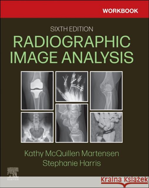 Workbook for Radiographic Image Analysis Stephanie, B.S. R.T.(R)(M)(CT) Harris 9780323930680 Elsevier - Health Sciences Division