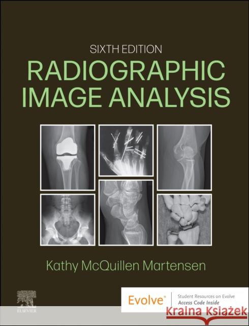 Radiographic Image Analysis Kathy, MA, RT(R) (Director of Radiologic Technology Education, Department of Radiology, The University of Iowa Hospitals 9780323930697 Elsevier - Health Sciences Division