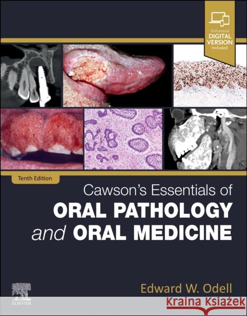 Cawson's Essentials of Oral Pathology and Oral Medicine Edward W, FDSRCS, MSc, PhD, FRCPath (Professor of Oral Pathology and Medicine, King's College London; Honorary Consultan 9780323935494