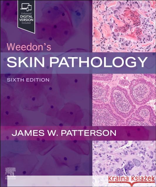 Weedon's Skin Pathology James W. Patterson 9780323935500 Elsevier