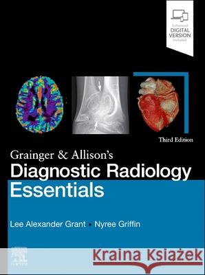 Grainger & Allison's Diagnostic Radiology Essentials Nyree (Consultant Radiologist, Guy's and St Thomas's NHS Foundation Trust, London, UK) Griffin 9780323936057 Elsevier - Health Sciences Division