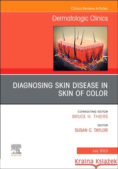 Diagnosing Skin Disease in Skin of Color, an Issue of Dermatologic Clinics: Volume 41-3 Taylor, Susan C. 9780323940375 Elsevier - Health Sciences Division