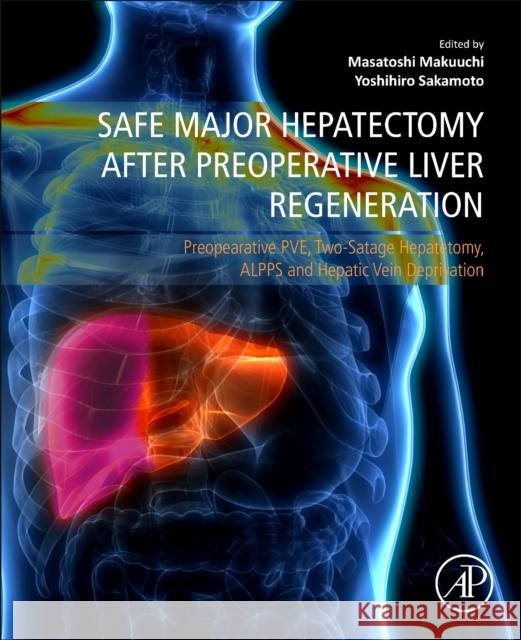 Safe Major Hepatectomy after Preoperative Liver Regeneration  9780323996983 Elsevier Science & Technology