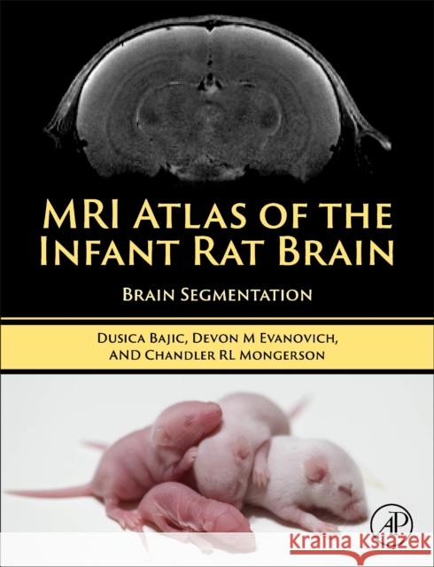 MRI Atlas of the Infant Rat Brain: Brain Segmentation Dusica Bajic Devon Evanovich Chandler Mongerson 9780323997676 Academic Press