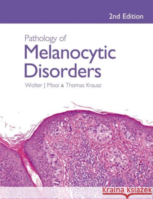 Pathology of Melanocytic Disorders 2ed Walter Mooi 9780340809686 0