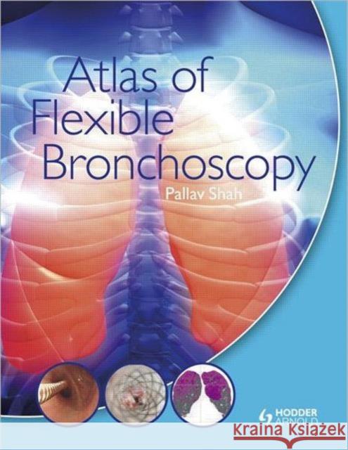 Atlas of Flexible Bronchoscopy Pallav Shah 9780340968321