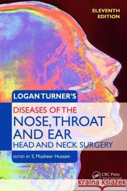 Logan Turner's Diseases of the Nose, Throat and Ear: Head and Neck Surgery, 11th Edition Hussain, S. Musheer 9780340987322 Taylor & Francis Ltd