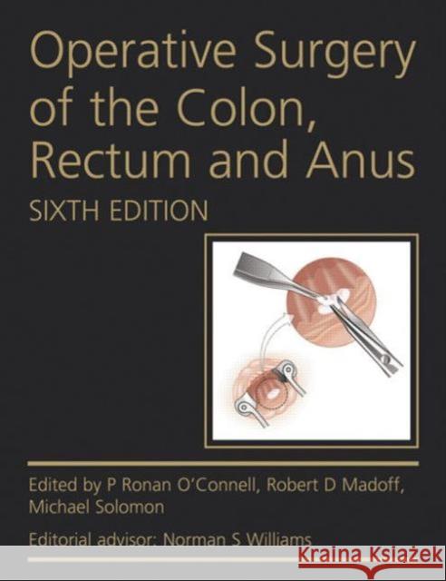 Operative Surgery of the Colon, Rectum and Anus Ronan O'Connell 9780340991275 0